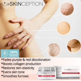 Skinception Intensive Stretch Mark Therapy Cream (9 Month Supply)